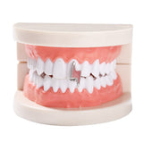 Grillz lightning drip braces hip hop dentures lightning